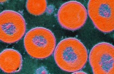 La-bacteria-de-neumococo-logra-evadir-la-vacuna-intercambiando-la-cpsula-que-la-recubre.-300x168