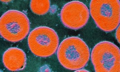 La-bacteria-de-neumococo-logra-evadir-la-vacuna-intercambiando-la-cpsula-que-la-recubre.-300x168