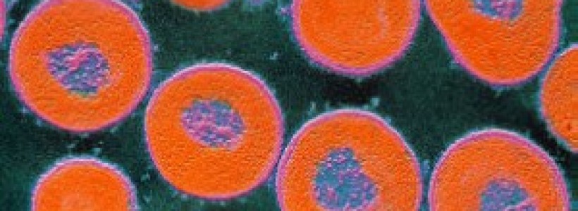 La-bacteria-de-neumococo-logra-evadir-la-vacuna-intercambiando-la-cpsula-que-la-recubre.-300x168