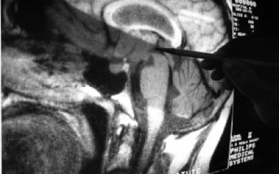brain630-300x241