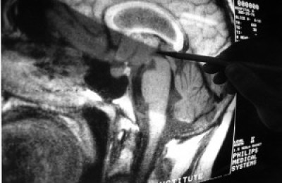 brain630-300x241