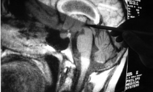 brain630-300x241