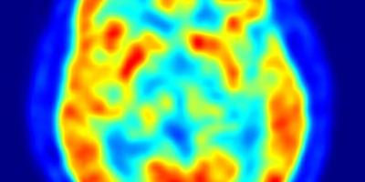 cerebro_estres68767878