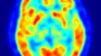 cerebro_estres68767878