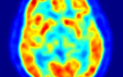 cerebro_estres68767878