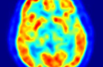 cerebro_estres68767878