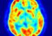 cerebro_estres68767878