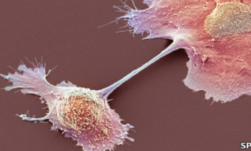 cancer_pancreas