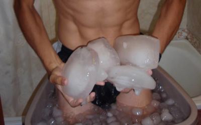 crioterapia