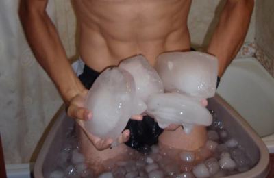 crioterapia