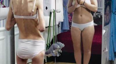 anorexia-y-bulimia15688998564345