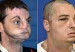 transplante_de_rostro_extraordinario
