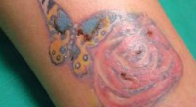 Riesgos-de-hacerse-un-tatuaje