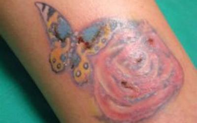 Riesgos-de-hacerse-un-tatuaje