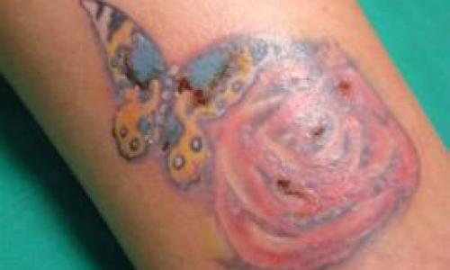 Riesgos-de-hacerse-un-tatuaje