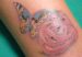 Riesgos-de-hacerse-un-tatuaje
