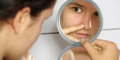 acne_6797665788998645
