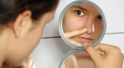 acne_6797665788998645