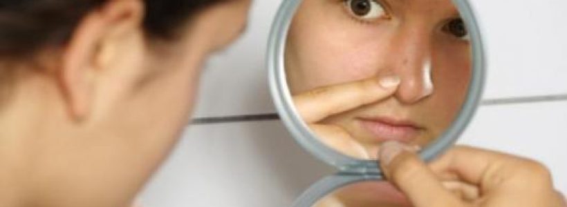 acne_6797665788998645