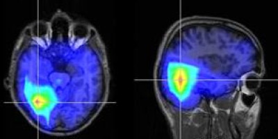 cerebro_bilingue-658788756