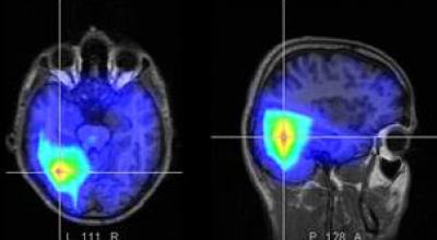 cerebro_bilingue-658788756