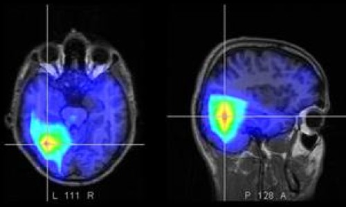 cerebro_bilingue-658788756