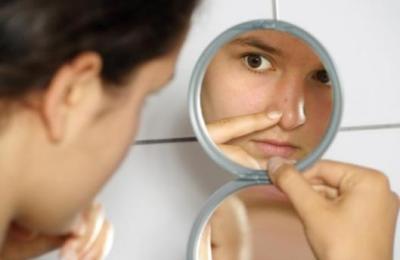 acne_6797665788998645