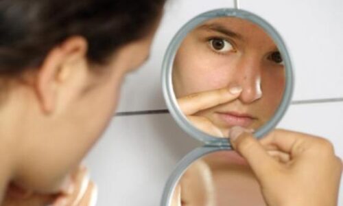 acne_6797665788998645