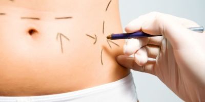 cirugia-plastica7688345657