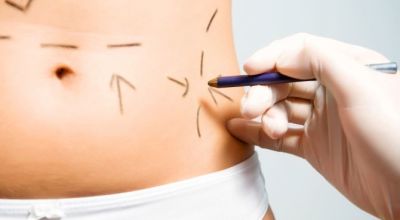 cirugia-plastica7688345657