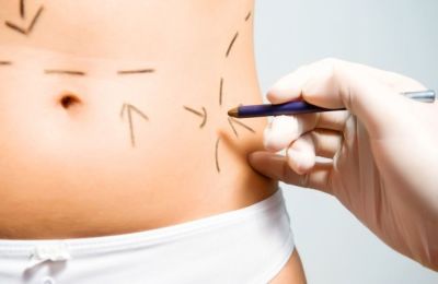 cirugia-plastica7688345657
