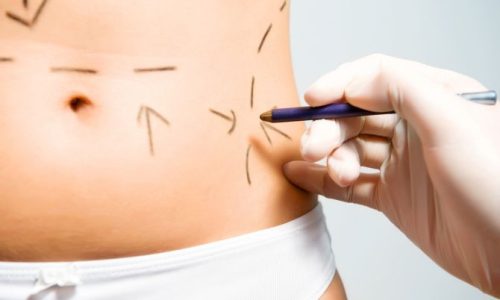 cirugia-plastica7688345657