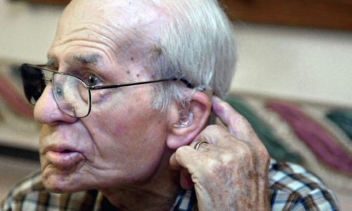 hombre-guinness-bala-craneo-94-anos
