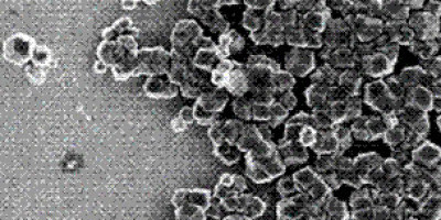 120507153500_bacterias_magneticas_304x171_universityofleeds