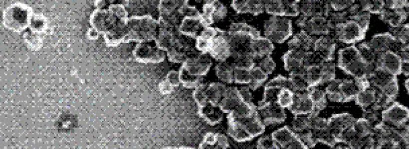 120507153500_bacterias_magneticas_304x171_universityofleeds