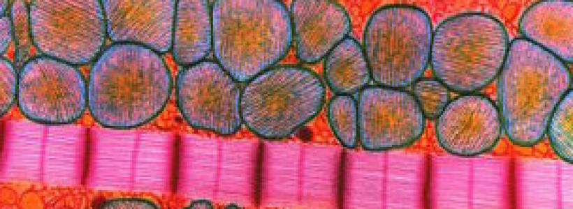 120523111315_heart_muscle_304x171_spl_nocredit