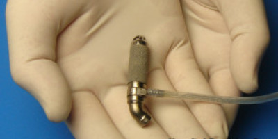 120525155534_microcorazon_304x171_hospitalbambinogesu