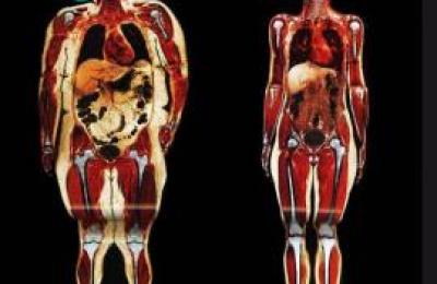 As-nos-afecta-la-obesidad