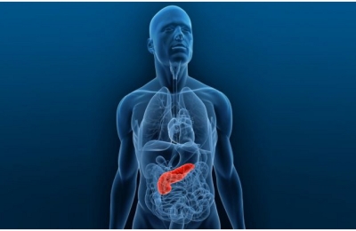 cancer-pancreas768675453