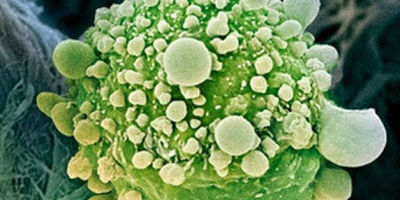 gen-detiene-cancer-pancreas_TINIMA20120430_0881_18