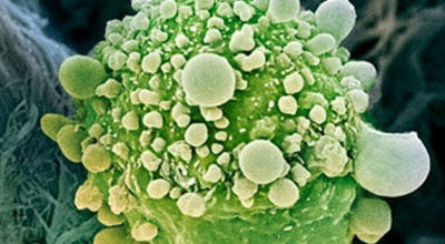 gen-detiene-cancer-pancreas_TINIMA20120430_0881_18