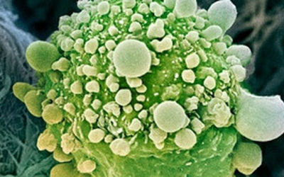gen-detiene-cancer-pancreas_TINIMA20120430_0881_18