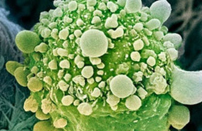 gen-detiene-cancer-pancreas_TINIMA20120430_0881_18