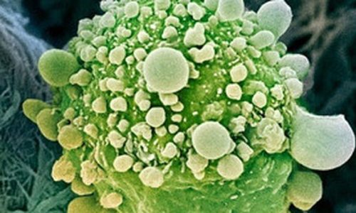 gen-detiene-cancer-pancreas_TINIMA20120430_0881_18