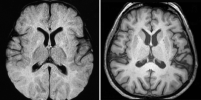 cerebro_como_esponjas6uyyujg76