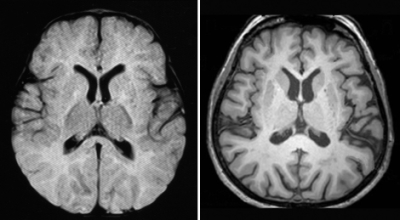 cerebro_como_esponjas6uyyujg76