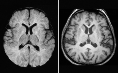cerebro_como_esponjas6uyyujg76