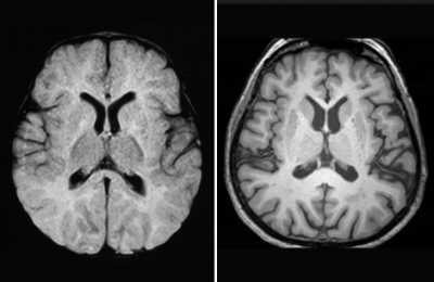 cerebro_como_esponjas6uyyujg76