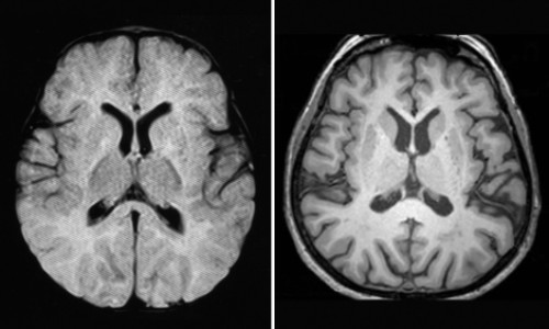 cerebro_como_esponjas6uyyujg76