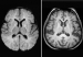cerebro_como_esponjas6uyyujg76